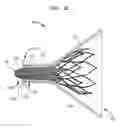 Fig. 14 - Assembly and method for loading a self-expanding collapsible heart valve