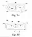 Fig. 02 - Spinal fusion implant