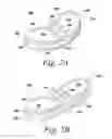 Fig. 03 - Spinal fusion implant