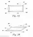 Fig. 04 - Spinal fusion implant