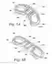 Fig. 06 - Spinal fusion implant