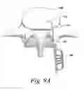 Fig. 10 - Spinal fusion implant