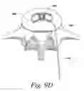 Fig. 13 - Spinal fusion implant