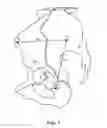 Fig. 02 - Method and apparatus for determining acetabular component positioning