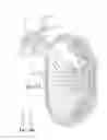 Fig. 06 - Method of retroperitoneal lateral insertion of spinal implants
