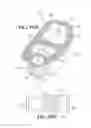Fig. 11 - Method of retroperitoneal lateral insertion of spinal implants