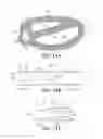 Fig. 12 - Method of retroperitoneal lateral insertion of spinal implants