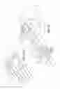 Fig. 14 - Method of retroperitoneal lateral insertion of spinal implants