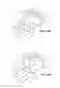 Fig. 15 - Method of retroperitoneal lateral insertion of spinal implants