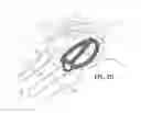 Fig. 20 - Method of retroperitoneal lateral insertion of spinal implants