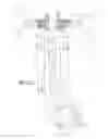Fig. 22 - Method of retroperitoneal lateral insertion of spinal implants
