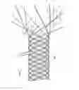 Fig. 02 - Secured strand end devices