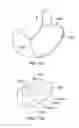 Fig. 15 - Methods, devices, and systems for obesity treatment