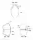 Fig. 17 - Methods, devices, and systems for obesity treatment