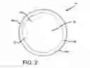 Fig. 03 - Support device for gastrointestinal implant