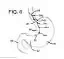 Fig. 07 - Support device for gastrointestinal implant