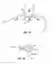 Fig. 04 - Systems and methods related to gastro-esophageal implants
