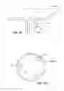 Fig. 05 - Systems and methods related to gastro-esophageal implants