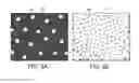 Fig. 04 - System for neuroprotective therapy for glaucoma