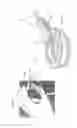 Fig. 20 - Apparatuses and methods for negative pressure wound therapy