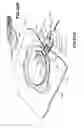 Fig. 44 - Apparatuses and methods for negative pressure wound therapy