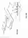 Fig. 45 - Apparatuses and methods for negative pressure wound therapy
