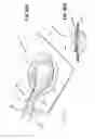Fig. 46 - Apparatuses and methods for negative pressure wound therapy