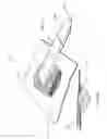 Fig. 71 - Apparatuses and methods for negative pressure wound therapy