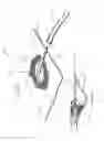 Fig. 76 - Apparatuses and methods for negative pressure wound therapy