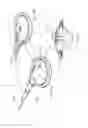 Fig. 77 - Apparatuses and methods for negative pressure wound therapy