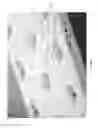 Fig. 90 - Apparatuses and methods for negative pressure wound therapy