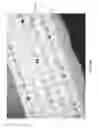 Fig. 91 - Apparatuses and methods for negative pressure wound therapy