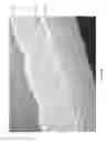 Fig. 92 - Apparatuses and methods for negative pressure wound therapy
