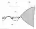 Fig. 01 - Method for producing a perforated web and product for a sanitary absorbent article thereof