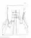 Fig. 01 - System and method for functional gait re-trainer for lower extremity pathology