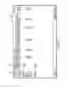 Fig. 15 - Systems and methods for compounding a preparation using a premix solution