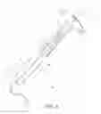 Fig. 05 - Dilation device for placing catheter tubes