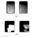 Fig. 02 - Dental compositions and methods of use