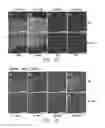 Fig. 18 - Compositions and methods for delivery of kinase inhibiting peptides