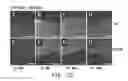 Fig. 19 - Compositions and methods for delivery of kinase inhibiting peptides