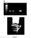 Fig. 13 - Methods and compounds for preventing osteoarthritis