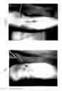 Fig. 03 - ANTI-ITCHING AGENT