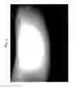 Fig. 05 - ANTI-ITCHING AGENT