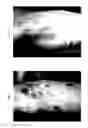 Fig. 02 - METHOD FOR TREATING ITCHING