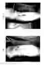 Fig. 03 - METHOD FOR TREATING ITCHING