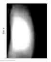 Fig. 05 - METHOD FOR TREATING ITCHING