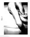 Fig. 06 - METHOD FOR TREATING ITCHING