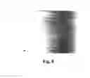 Fig. 09 - Bioactive glass preparation and use