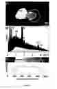 Fig. 09 - COMPOSITION FOR PROPHYLAXIS AND TREATMENT OF BONE DISORDERS