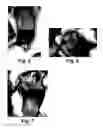 Fig. 06 - Compositions and methods for treating itching, gingivostomatitis, and demodectic mange